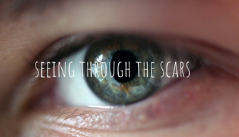 Seeing Through the Scars